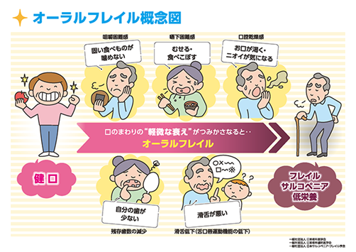 オーラルフレイル