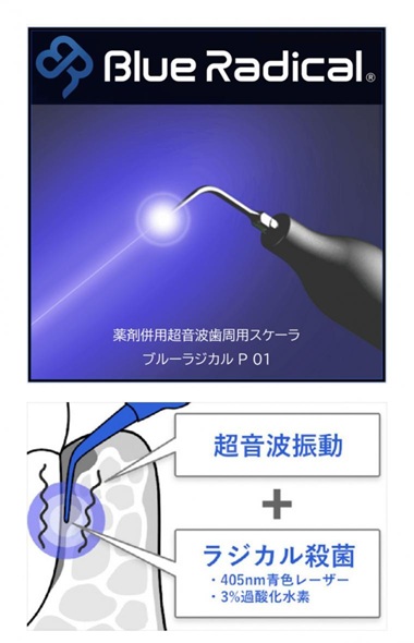 ブルーラジカル